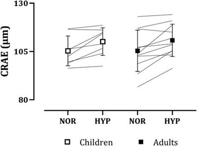 Retinal blood vessel diameters in children and adults exposed to a simulated altitude of 3,000 m